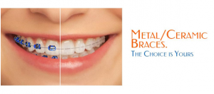 Orthodontic-Treatment1