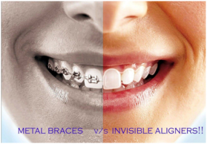 Orthodontic-Treatment2